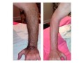 hair-removal-wax-training-facebody-small-10
