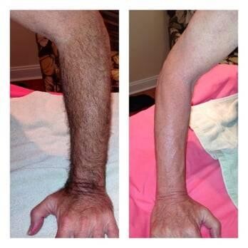 hair-removal-wax-training-facebody-big-10