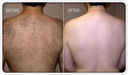 hair-removal-wax-training-facebody-big-7